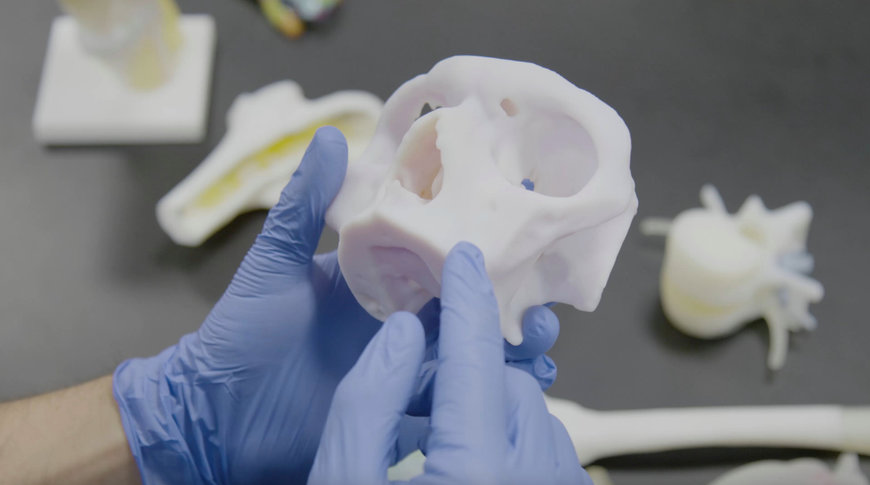 STRATASYS SIGNS AGREEMENT WITH RICOH USA FOR PRINT-ON-DEMAND MEDICAL MODELS 